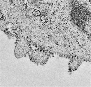 Hỏi: Virus Covid-19 có ở đâu trong môi trường xung quanh chúng ta?